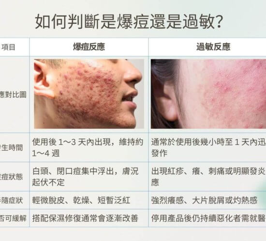 如何判斷是爆痘還是過敏？ 爆痘期 vs. 過敏反應對比圖 項目 爆痘反應 過敏反應 發生時間 使用後 1～3 天內出現，維持約 1～4 週 通常於使用後幾小時至 1 天內迅速發作 痘痘狀態 白頭、閉口痘集中浮出，膚況起伏不定 出現紅疹、癢、刺痛或明顯發炎反應 伴隨症狀 輕微脫皮、乾燥、短暫泛紅 強烈癢感、大片脫屑或灼熱感 是否可緩解 搭配保濕修復通常會逐漸改善 停用產品後仍持續惡化者需就醫